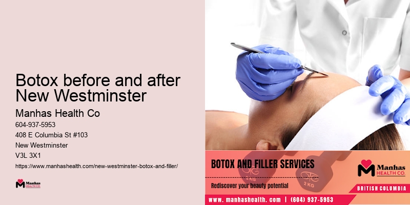 Best physio Coquitlam