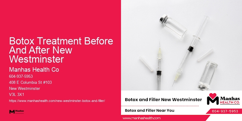 Botox treatment availability Botox Treatment Before And After New Westminster