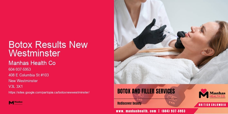 Botox for facial volume Botox Results New Westminster