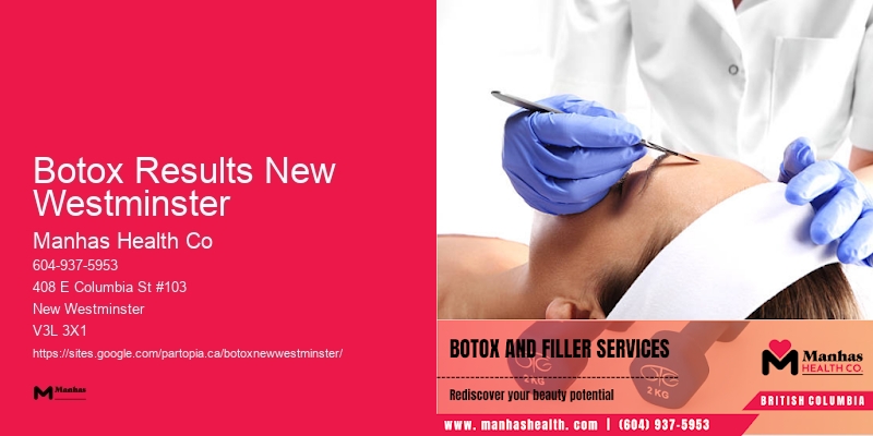 Botox for smile line correction Botox Results New Westminster