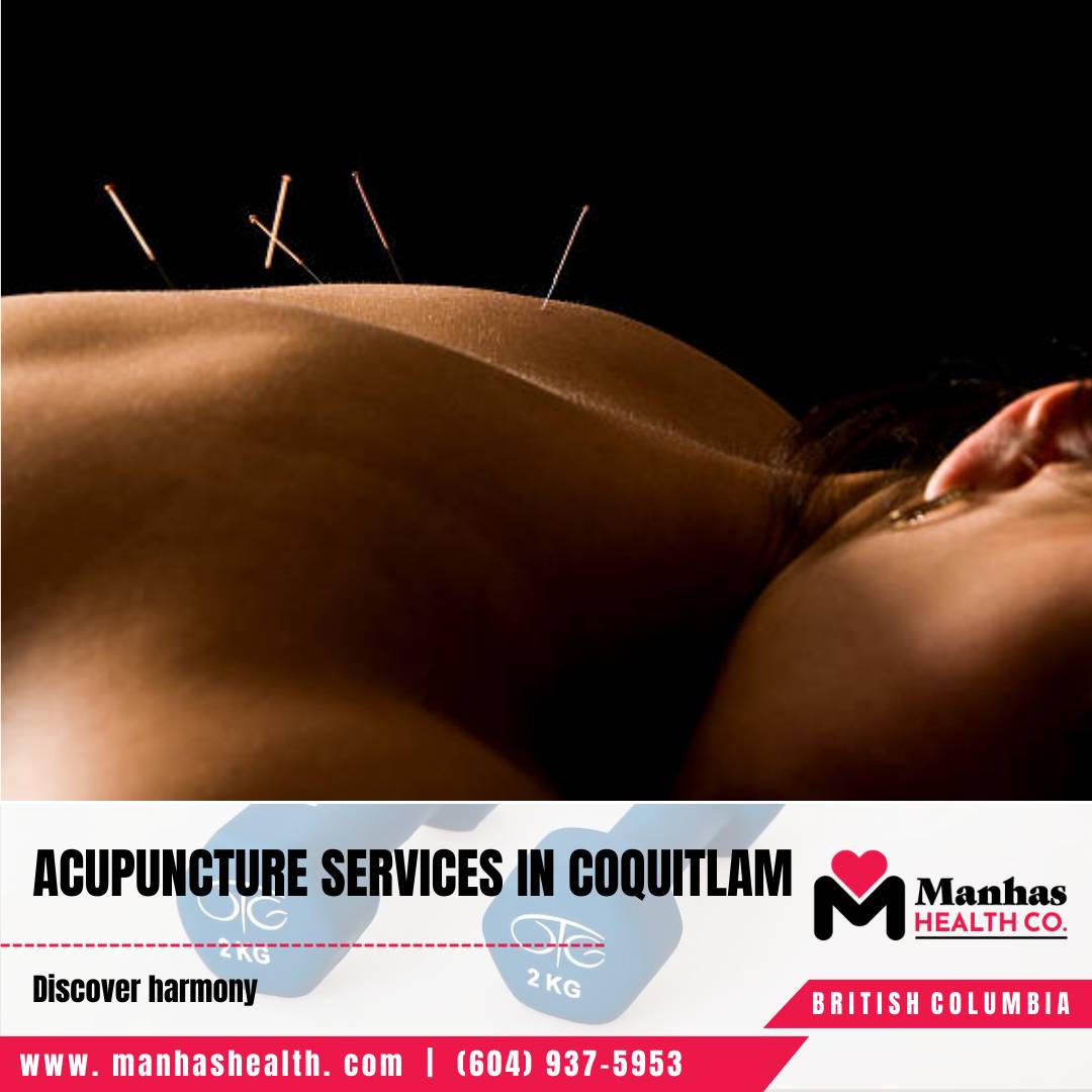 Best Physiotherapist Coquitlam