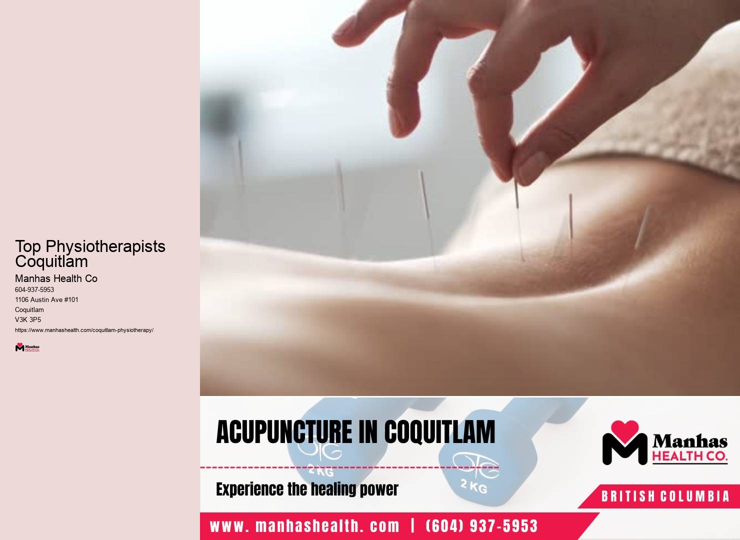 Physiotherapy for sciatic nerve pain Top Physiotherapists Coquitlam