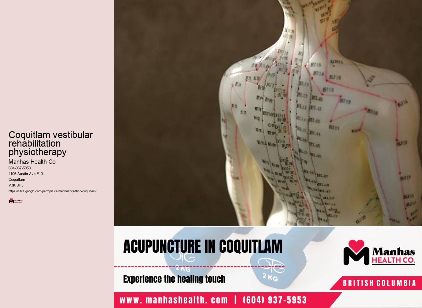 TMJ physiotherapy expert Coquitlam vestibular rehabilitation physiotherapy
